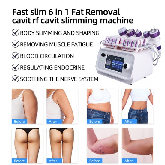 Rf Cavitation Vacuum Weight Loss Device Body Slimming Weight Loss Products