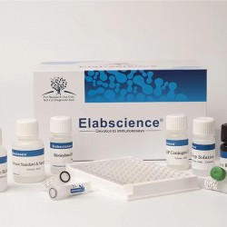 Human IL-6(Interleukin 6)  ELISA Kit