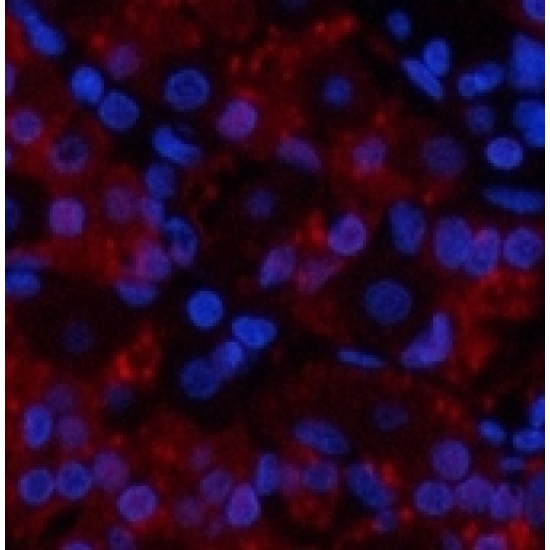 TNF Alpha Polyclonal Antibody