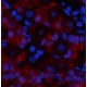TNF Alpha Polyclonal Antibody
